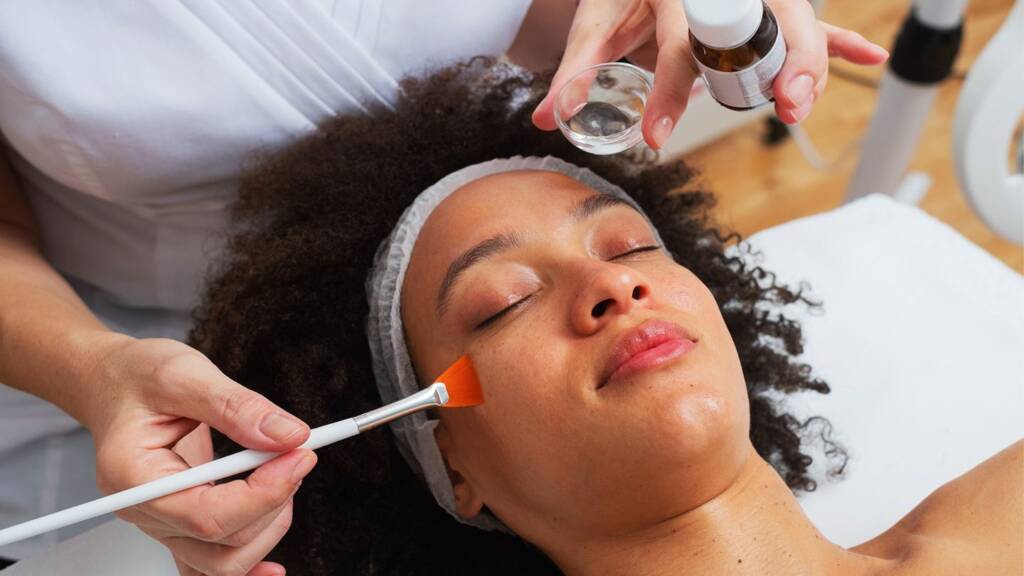 chemical peels