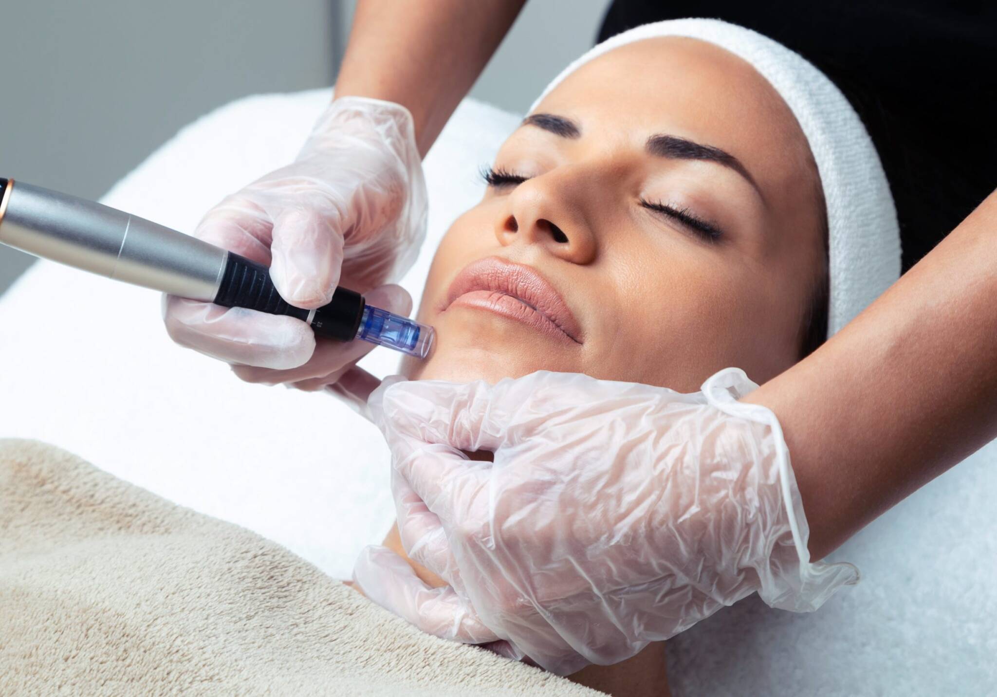 Microneedling or Collagen Induction in Hollywood FL - Skin Ritualist